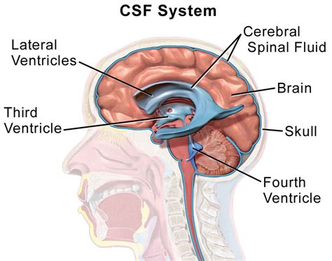 csf yellow fluid leaking from nose|Cerebrospinal Fluid (CSF) Leak